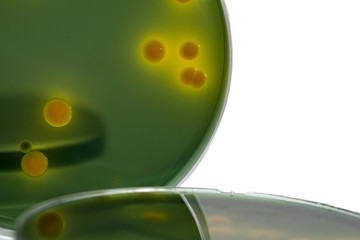 Closeup for plate Bacteria culture growth on Selective media, vibrio spp