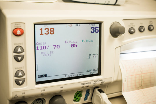 horizontal image of Cardiotocography , fetal heartbeat monitor, also electronic fetal monitor.  Recording on graph paper