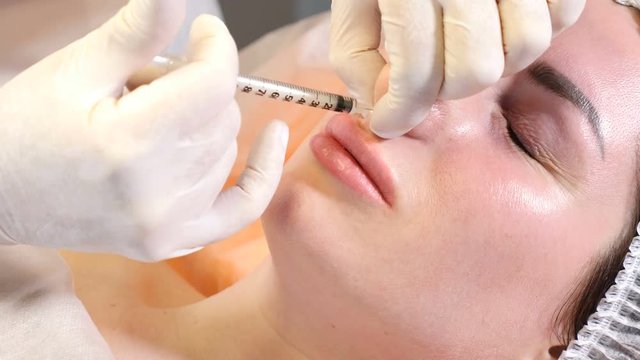 Beauty clinic concept. Close-up of beautician hands making botox injection to female lips and nose. Young woman gets facial injection procedur.. Facial rejuvenation. 4k