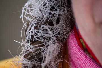 Funny women's braid - covered with hoarfrost on frosty winter day during a walk.