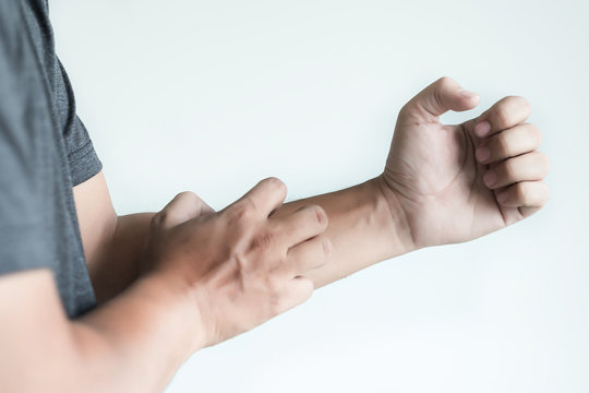 itchy  arms scratching  Healthcare And Medicine Health problem