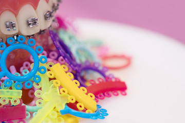 orthodontic model and dentist tool - demonstration teeth model of varities of orthodontic bracket or brace