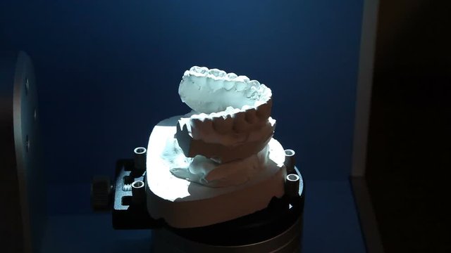 Scanning of the impression of the teeth for further printing on the printer. Dental prosthesis, dentures, prosthetics 