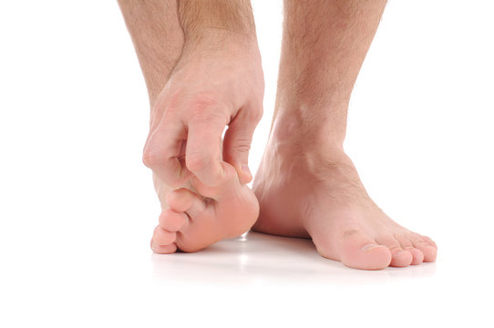 Man scratch the itch with hand. Infection of the feet caused by fungus.