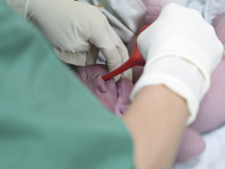 Pediatric doctor or hands wearing white sterile surgical gloves and doing suction for newborn baby using suction ball after natural or cesarean section birth in labour or nursery room at hospital