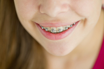 Girl with braces
