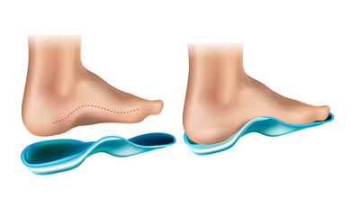 Orthopedic Insole.  Orthotic Arch Support