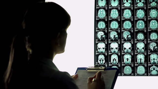 Female neurologist looking thoughtful at brain x-ray, writing down diagnosis
