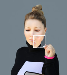 Acne.Post-Acne Marks /Treating Acne Scars