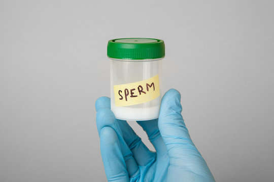 Doctor in the glove holds a jar with  sample of sperm to analyze the motility of the sperm. The concept of sperm bank