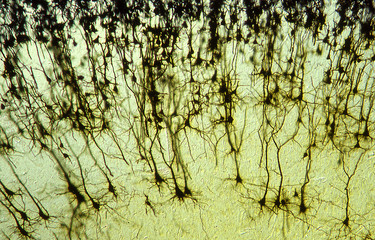 Gehirn mit vernetzten Nervenzellen 