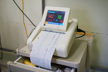 Cardiotocograph recording fetal heart rate