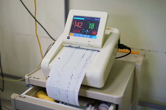 Cardiotocograph recording fetal heart rate