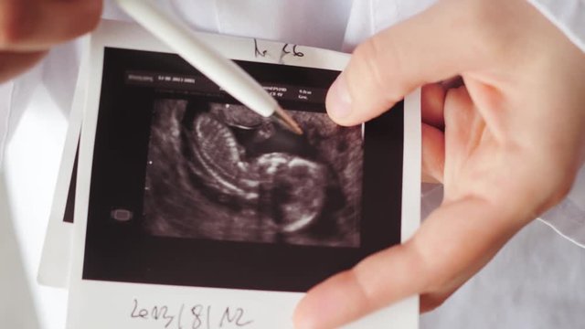 doctor showing embryo, child on printout of ultrasound examination
