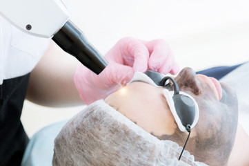Close-up carbon face peeling procedure. Laser pulses clean skin of the face. Hardware cosmetology...
