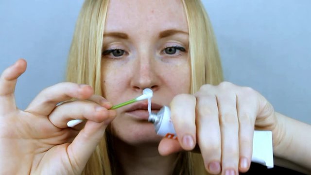 Beautiful young woman, lips infected with herpes virus. The concept of treatment of the herpes virus