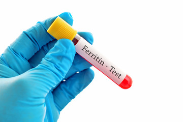 Obraz premium Test tube with blood sample for ferritin test 