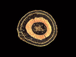 Hoya carnosa - microscopic cross section cut of a plant stem - dark field