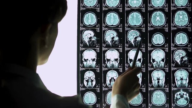 Young neurosurgeon calculating degree of patients brain concussion on MRI scans