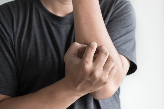 itchy  arms scratching  Healthcare And Medicine Health problem