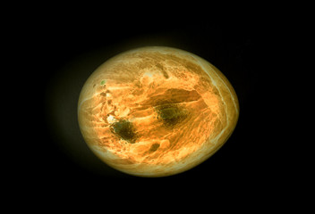 Painted egg, easter - X-Ray