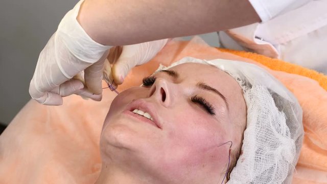 Healtcare clinic. Young female client gets thread face lifting procedure. Beautician in gloves making face anti-aging to a female face