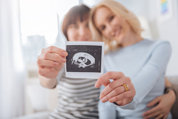 We are pregnant. Selective focus of an ultrasound photo being held by a joyful nice female couple