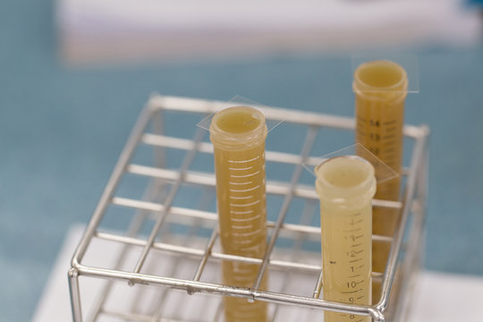 Finding parasites in feces in laboratory.