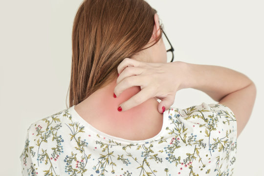 Close Up View Of Woman Scratching Her Neck.