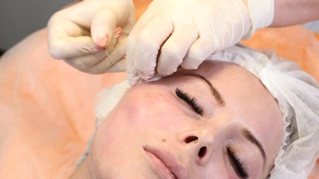 Healtcare clinic. Young female client gets thread face lifting procedure. Beautician in gloves making face anti-aging to a female face