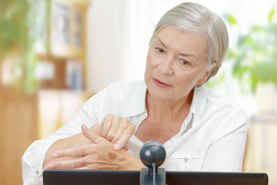Senior woman in front of a computer with an attached camera showing her doctor a mole on her hand during video call, teledermatology concept.
