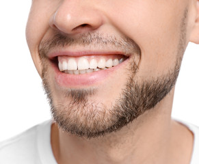 Obraz premium Young man with beautiful smile on white background. Teeth whitening