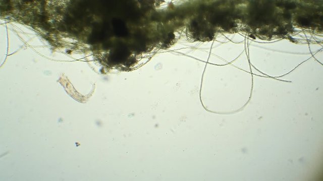 Puddle drop with a rotifer seen under a microscope