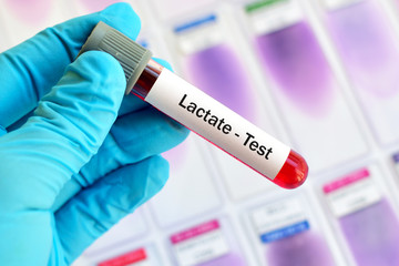 Test tube with blood sample for lactate test
