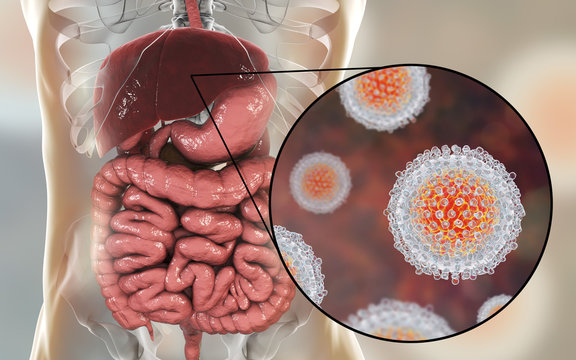 Hepatitis C virus infection medical concept
