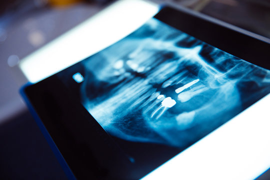 woman dentist observing a mouth x-ray in the clinic