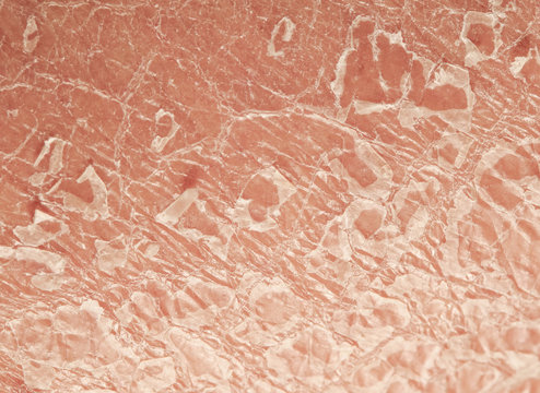 the texture of the epidermis of human skin with flakes and cracked particles closeup