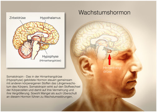 Hirnanhangdr&uuml;se.Wachstumsst&ouml;rungen