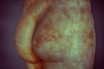 Stone bottom