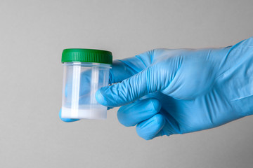 Analysis of sperm on the mobility of spermatozoa. The seed of the sperm in the jar for analysis is held by the doctor's hand in the glove.