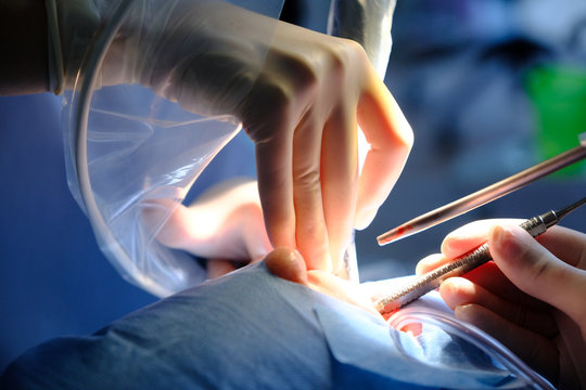 The hands of the dentist and the assistant in protective gloves with the instrument in the treatment of the patient