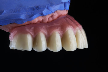 high-quality dental prosthesis made of plastic, upper jaw, side view, lateral teeth on a black background