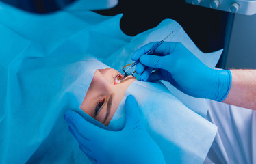 Laser vision correction. A patient in the operating room during ophthalmic surgery. Eyelid speculum. Lasik treatment. - obrazy, fototapety, plakaty