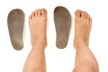 Top view of orthopedic insoles for shoes and kids legs