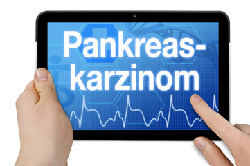 Tablet mit Diagnose pankreaskarzinom