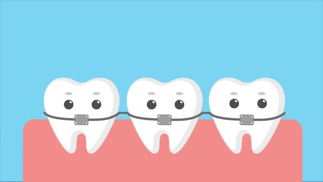 Cartoon teeth with braces.