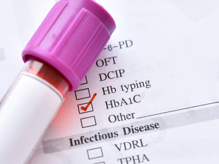 Blood sample for HbA1c test, diabetes diagnosis 