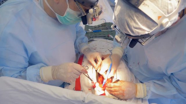 A group of doctors are performing an open heart operation with surgical tools