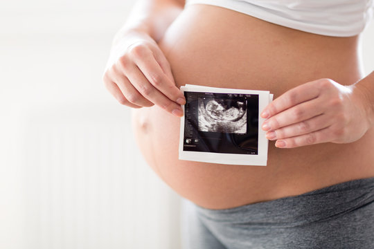 Pregnant woman holding ultrasound photo on belly