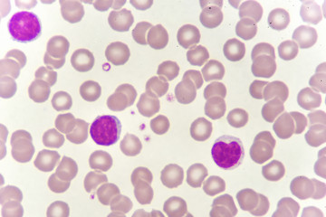 Lymphocyte cells (white blood cell) in blood smear, analyze by microscope
